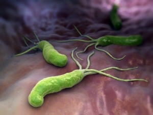Helicobacter digestconfort heba HE COMPLEX